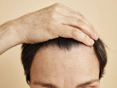 How to Grow Hair in the Forehead Area (Front Hairline)