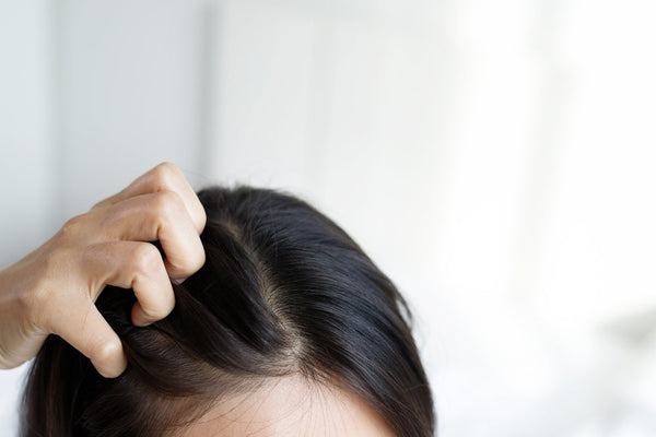 The main causes of dandruff in hair
